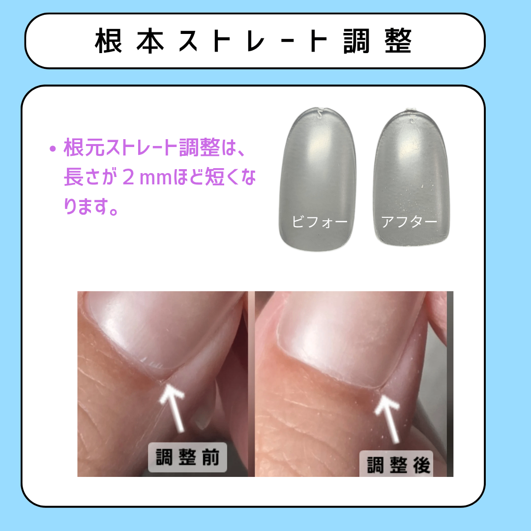 ぷっくりきらめくクラゲアート 5枚目