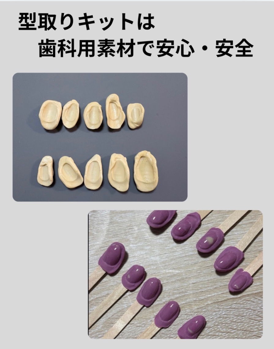 ジェルアレルギー対応・爪の型から作る完全オーダーメイドネイルチップ（歯科素材使用） 6枚目